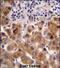 Psoriasis Susceptibility 1 Candidate 1 antibody, PA5-71794, Invitrogen Antibodies, Immunohistochemistry frozen image 