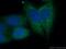 Tudor and KH domain-containing protein antibody, 13528-1-AP, Proteintech Group, Immunofluorescence image 