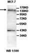 Hephaestin antibody, orb77635, Biorbyt, Western Blot image 