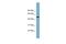 Serine Protease 16 antibody, A12328, Boster Biological Technology, Western Blot image 