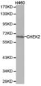 Checkpoint Kinase 2 antibody, LS-C192960, Lifespan Biosciences, Western Blot image 