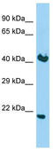 KDEL Endoplasmic Reticulum Protein Retention Receptor 2 antibody, TA332202, Origene, Western Blot image 