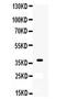 X-Ray Repair Cross Complementing 3 antibody, PA1697, Boster Biological Technology, Western Blot image 