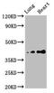 Tumor Suppressor Candidate 3 antibody, LS-C681642, Lifespan Biosciences, Western Blot image 