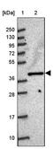 Molybdenum Cofactor Synthesis 1 antibody, PA5-61093, Invitrogen Antibodies, Western Blot image 
