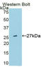 Transmembrane Protein 173 antibody, LS-C296781, Lifespan Biosciences, Western Blot image 