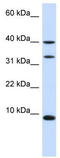 Diazepam Binding Inhibitor, Acyl-CoA Binding Protein antibody, TA332222, Origene, Western Blot image 