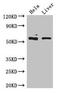 Keratin 81 antibody, LS-C396919, Lifespan Biosciences, Western Blot image 