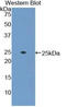 Adenylate Cyclase 6 antibody, LS-C292646, Lifespan Biosciences, Western Blot image 