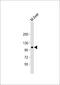 Phosphoribosylglycinamide Formyltransferase, Phosphoribosylglycinamide Synthetase, Phosphoribosylaminoimidazole Synthetase antibody, 61-306, ProSci, Western Blot image 