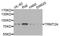 TRNA Methyltransferase 2 Homolog A antibody, STJ29175, St John