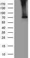 Long-chain-fatty-acid--CoA ligase 5 antibody, TA811872S, Origene, Western Blot image 