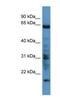 G Protein-Coupled Receptor Kinase 7 antibody, NBP1-68989, Novus Biologicals, Western Blot image 
