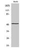 MAP kinase-interacting serine/threonine-protein kinase 1 antibody, STJ94170, St John