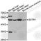 Somatostatin Receptor 1 antibody, A3134, ABclonal Technology, Western Blot image 