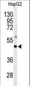 G Protein Subunit Alpha Z antibody, LS-C166555, Lifespan Biosciences, Western Blot image 