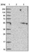 Cytochrome P450 Family 2 Subfamily W Member 1 antibody, PA5-52979, Invitrogen Antibodies, Western Blot image 