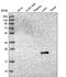 CD224 antibody, PA5-61058, Invitrogen Antibodies, Western Blot image 