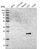 Gamma-Glutamyltransferase 1 antibody, PA5-61058, Invitrogen Antibodies, Western Blot image 