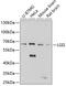 Leucine-rich glioma-inactivated protein 1 antibody, GTX66465, GeneTex, Western Blot image 