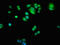 Adenosine Kinase antibody, LS-C669675, Lifespan Biosciences, Immunofluorescence image 