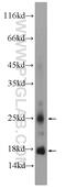 Crystallin Gamma N antibody, 21281-1-AP, Proteintech Group, Western Blot image 