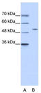 Zinc Finger Protein 555 antibody, TA341497, Origene, Western Blot image 