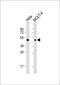 Mitogen-Activated Protein Kinase Kinase 2 antibody, 63-309, ProSci, Western Blot image 