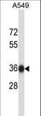 NSF Attachment Protein Beta antibody, LS-C164742, Lifespan Biosciences, Western Blot image 