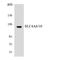 Solute Carrier Family 4 Member 8 antibody, LS-C200695, Lifespan Biosciences, Western Blot image 