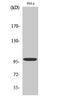 Catenin Alpha 1 antibody, STJ92034, St John