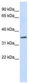 TRNA-YW Synthesizing Protein 5 antibody, TA339897, Origene, Western Blot image 