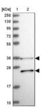 Retinol Dehydrogenase 13 antibody, NBP1-92324, Novus Biologicals, Western Blot image 