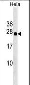 Dynactin Subunit 6 antibody, LS-B12076, Lifespan Biosciences, Western Blot image 