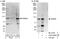 Phosphodiesterase 8A antibody, A303-040A, Bethyl Labs, Western Blot image 