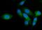 Adaptor Related Protein Complex 2 Subunit Alpha 2 antibody, A08527-1, Boster Biological Technology, Immunofluorescence image 