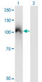 Cbl Proto-Oncogene antibody, LS-C196826, Lifespan Biosciences, Western Blot image 