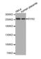 Ryanodine Receptor 2 antibody, abx000677, Abbexa, Western Blot image 