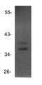 H6 Family Homeobox 3 antibody, NBP1-69011, Novus Biologicals, Western Blot image 