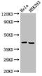 Actin Related Protein 2/3 Complex Subunit 1A antibody, LS-C672442, Lifespan Biosciences, Western Blot image 