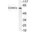 Eomesodermin antibody, LS-C199846, Lifespan Biosciences, Western Blot image 