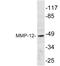 Matrix Metallopeptidase 12 antibody, AP20790PU-N, Origene, Western Blot image 