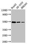 Squalene synthase antibody, CSB-PA008562LA01HU, Cusabio, Western Blot image 