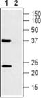 Calcium Voltage-Gated Channel Auxiliary Subunit Gamma 1 antibody, PA5-77347, Invitrogen Antibodies, Western Blot image 