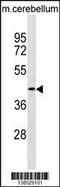 Tropomodulin 2 antibody, 59-875, ProSci, Western Blot image 