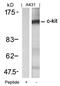 c-Kit antibody, 79-591, ProSci, Western Blot image 