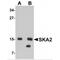 Spindle And Kinetochore Associated Complex Subunit 2 antibody, MBS150123, MyBioSource, Western Blot image 