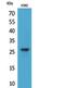 Fibroblast growth factor 8 antibody, STJ96802, St John