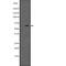 Receptor Interacting Serine/Threonine Kinase 2 antibody, abx146698, Abbexa, Western Blot image 