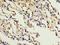 ADA33 antibody, LS-C379289, Lifespan Biosciences, Immunohistochemistry paraffin image 